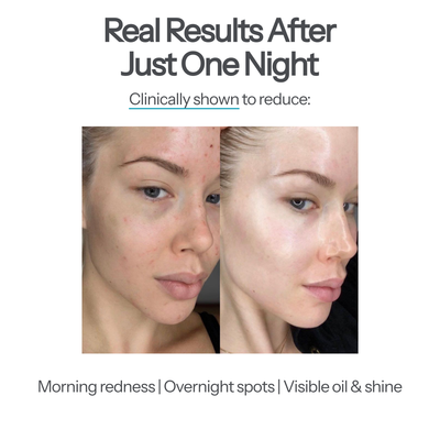 Clean Sleep System