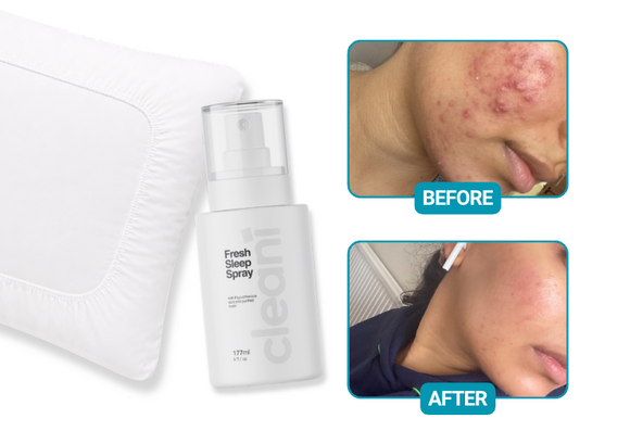Feature product image